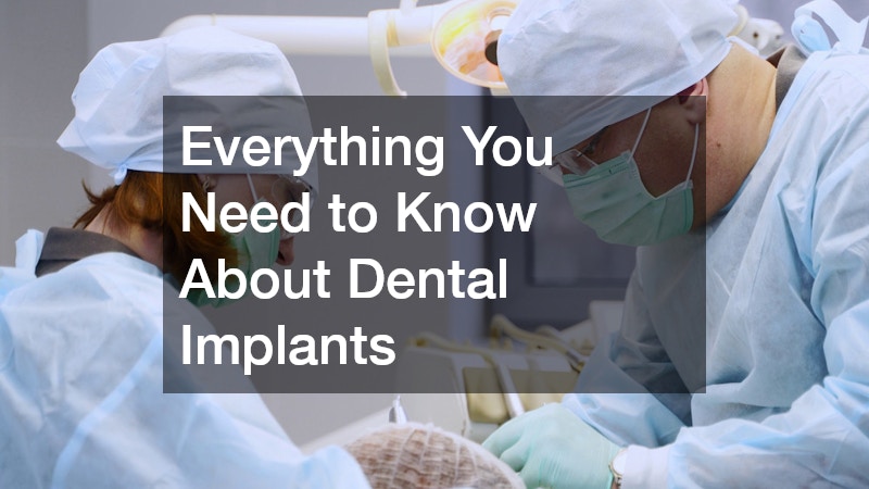 Everything You Need to Know About Dental Implants